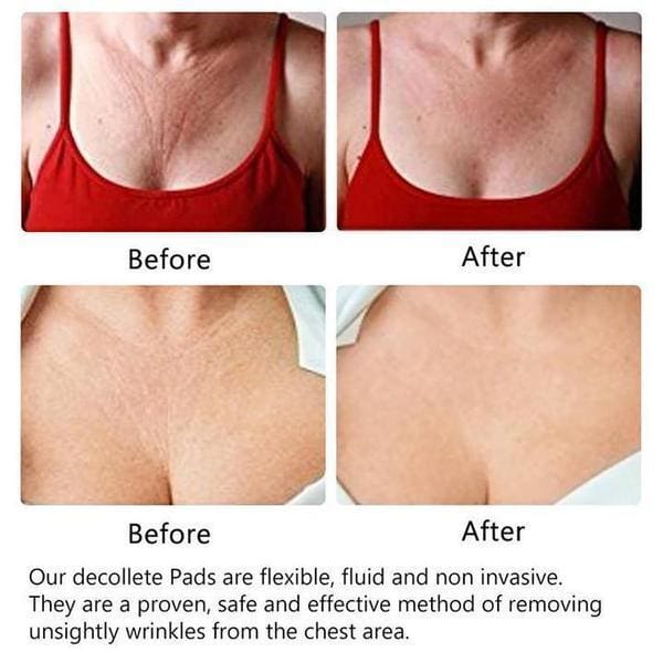 Anti-Wrinkle Chest Pads